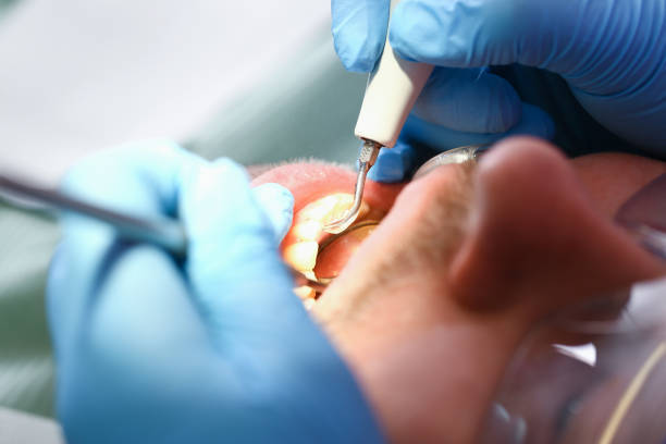 Best Broken Tooth Emergency  in Crosby, MN